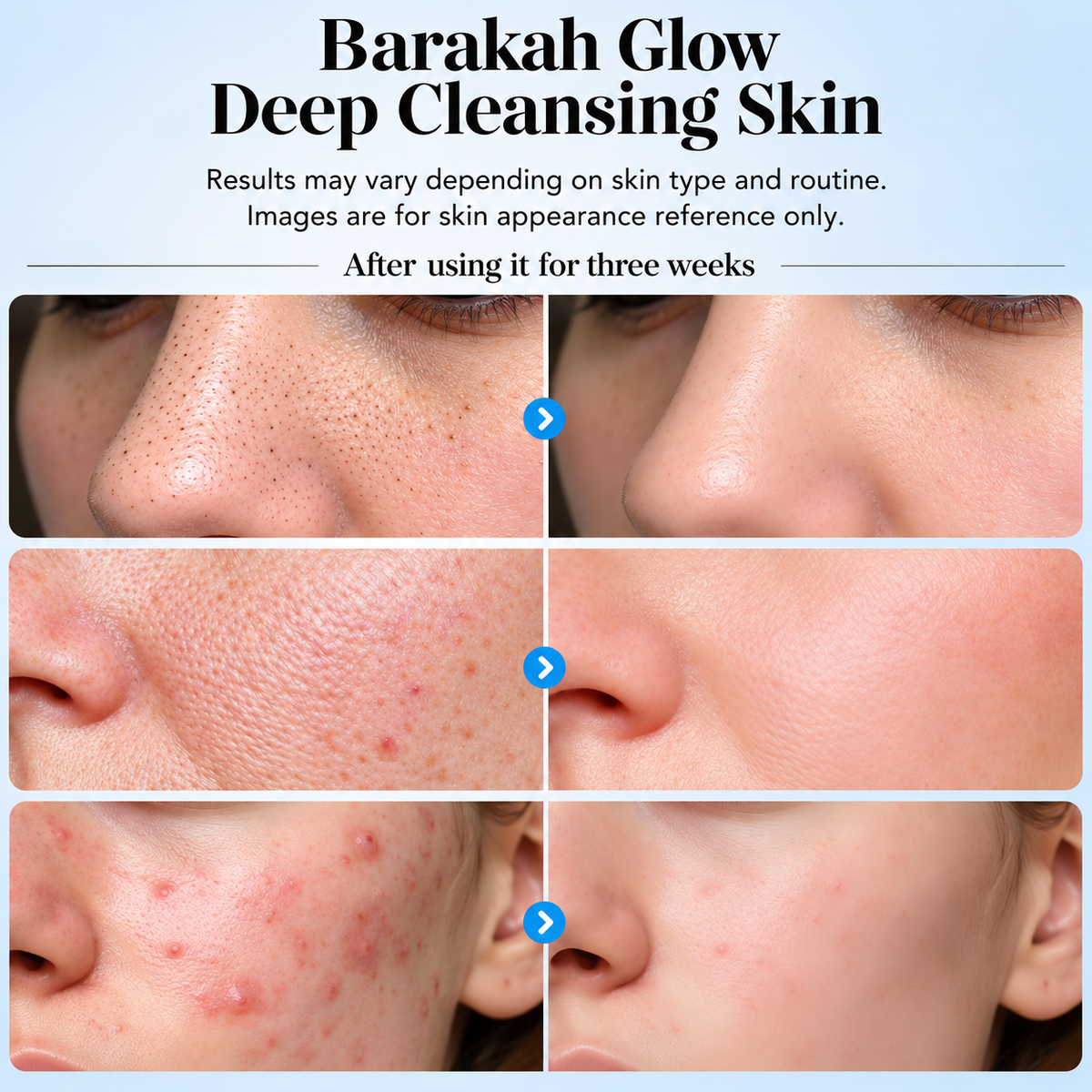Barakah Glow™ Ultrasonic Skin Scrubber