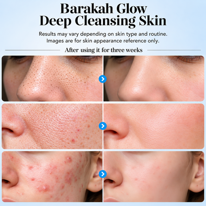 Barakah Glow™ Ultrasonic Skin Scrubber