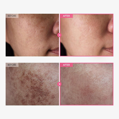 Barakah Glow™  Advanced Arbutin Brightening Cream