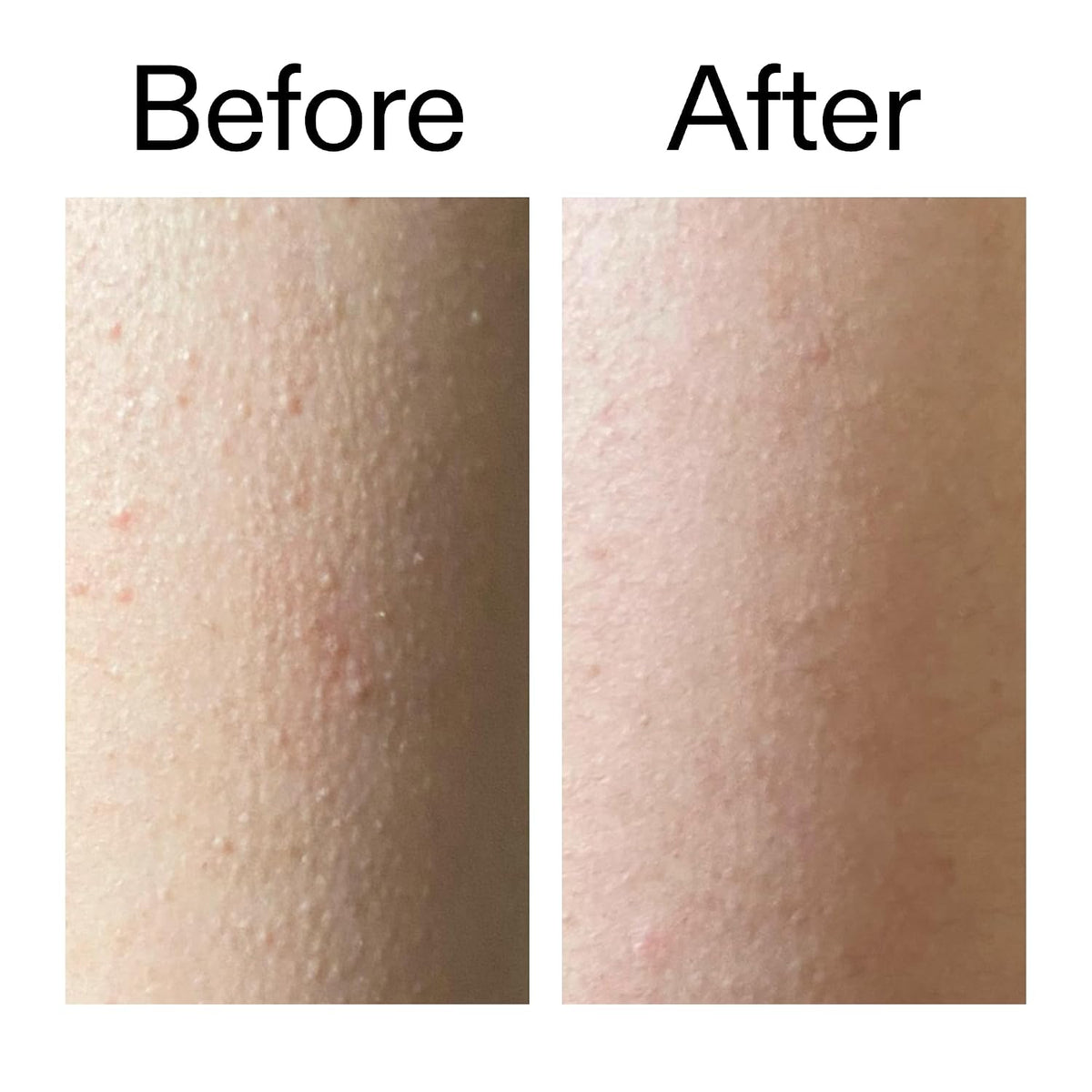 Barakah Glow™ Glycolic Acid Body Exfoliating Stick
